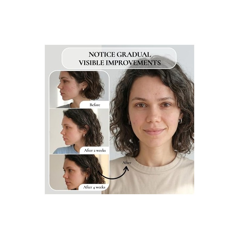 Vivo Per Lei Facial Peeling, 1.7-fluid Ounce by Vivo per