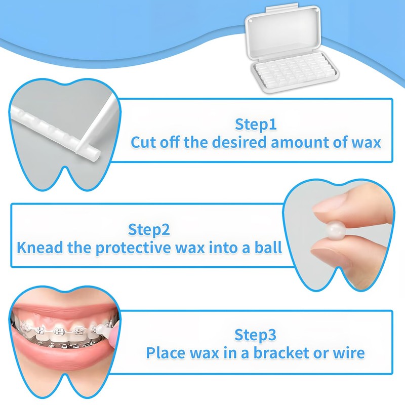 Orthodontic Wax for Braces,Dental Wax for Braces,6 Boxes Braces Wax