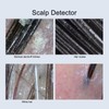 3MP Scalp Detector Portable Wireless Skin Dignosis WiFi Detector Handheld