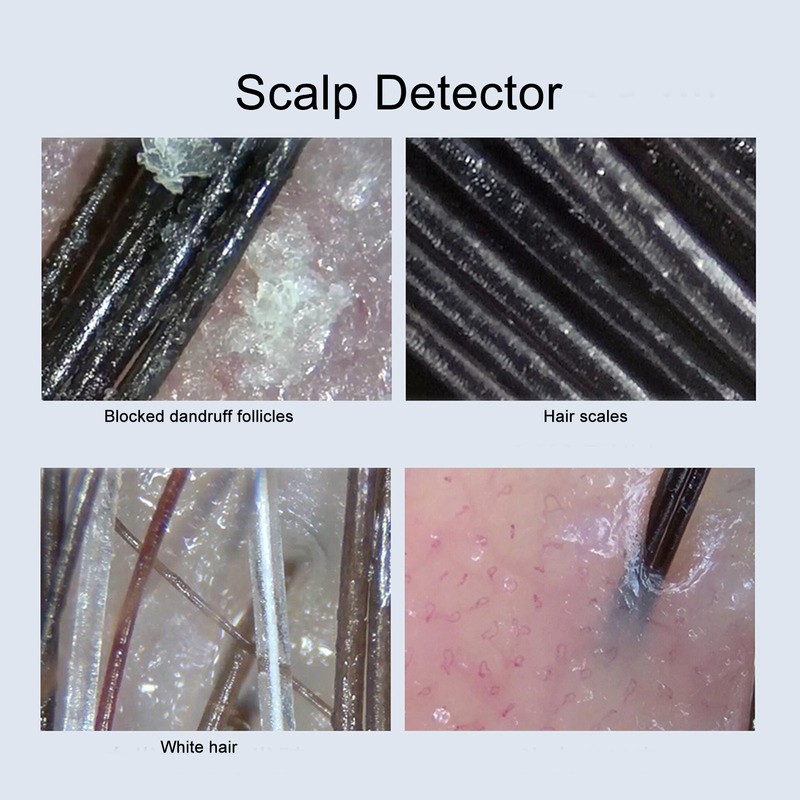 3MP Scalp Detector Portable Wireless Skin Dignosis WiFi Detector Handheld