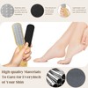 START MAKERS Foot File, 2Pcs Foot Scrubber Callus Remover for