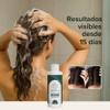 Shampoo Capilar Alquitrán Psoriasis, Caspa Matimati 425ml