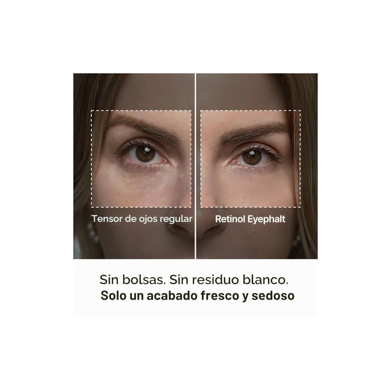 Dr.Melaxin Retinol Eyebag Cream for Puffiness, Dark Circles & Fine