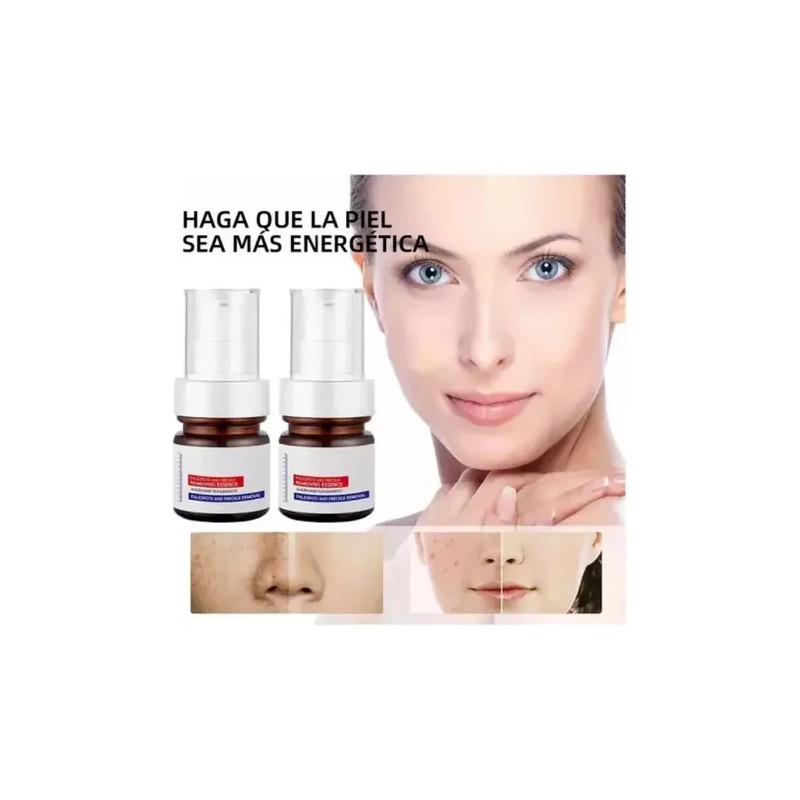 Whitening Y Freckle Eliminar La Esencia,aobenz