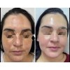 Tónico Facial Lumi Radiance+jabón Adiós Manchas Farmasi