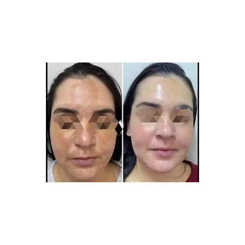 Tónico Facial Lumi Radiance+jabón Adiós Manchas Farmasi