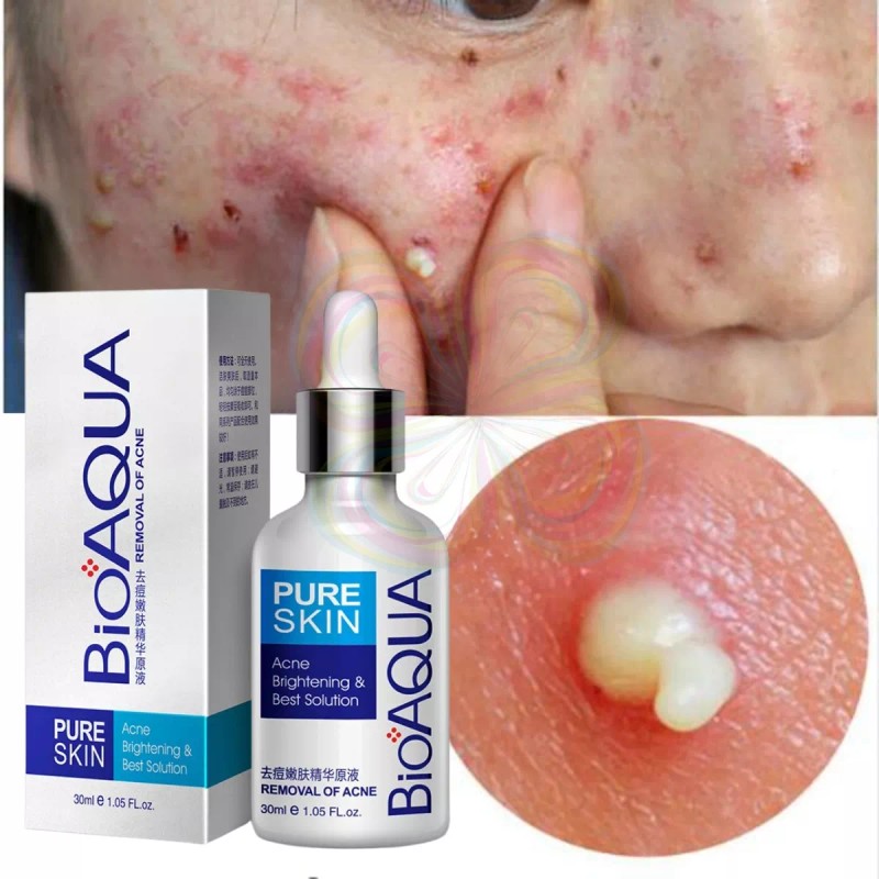 Bioaqua Crema+ Serum Bioaqua Pure Skin Tratamiento Anti-acne Manchas