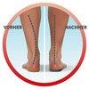 Scholl In-Balance 3/4 Insoles for knee to heel pain. 3077350