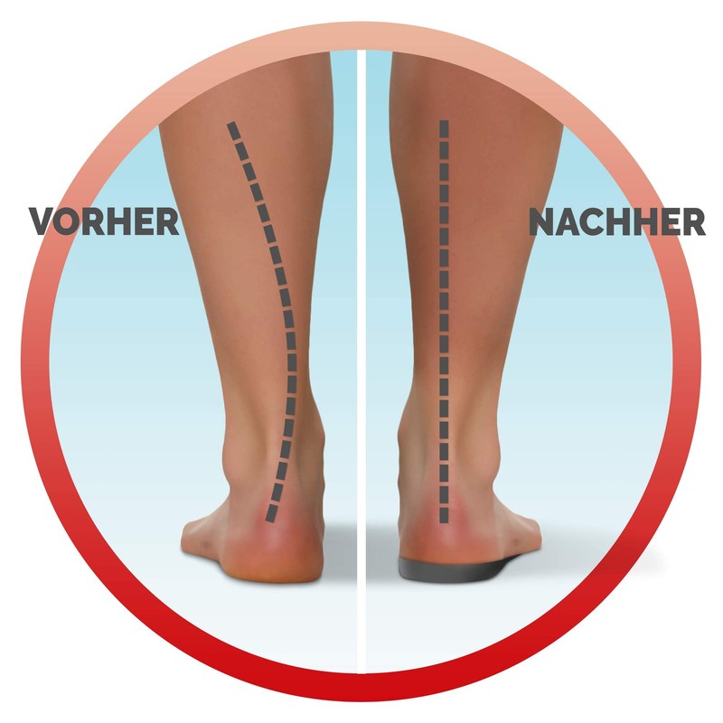 Scholl In-Balance 3/4 Insoles for knee to heel pain. 3077350