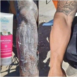 Sheló Nabel Crema Depiladora De Extractos Naturales, Para Piel Sensible