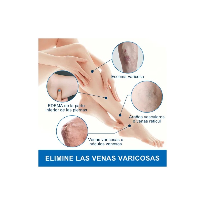 Crema De Venas Varicosas Reducir Las Venas Varicosas 20g