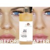 Cleansing Lotion Oily Skin with Witch Hazel and Rosemary Leaf