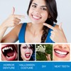 Dental Temporary Tooth Cap Crown Veneers Front Back Anterior and