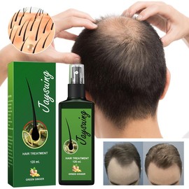 Hair Growth Spray Ginger Massage Scalp Damaged Treatment Solution Nourish Roots Fast Grow Anti Hair Loss Serum Beauty Health, Haircare Repair - Specification: 1PCS