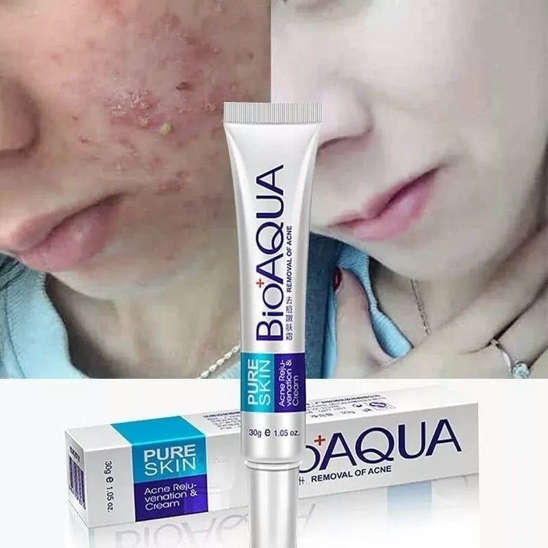 Bioaqua Crema Eliminación Acné Granos En Piel Cierra Poros