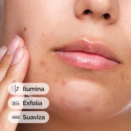 KIREO Sérum Niacinamida 10% + Zinc 1% 30ml Antiacné Hidratante Facial