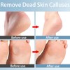 HREDZEO 2in1 Nano Glass Foot File for Foot Spa