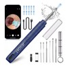 JEGOAT Ear Wax Removal EarWax Removal Tool with 1296P HD