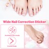 Ingrown Toenail Removal Kit Professional Ingrown Toenail Tool Kit with