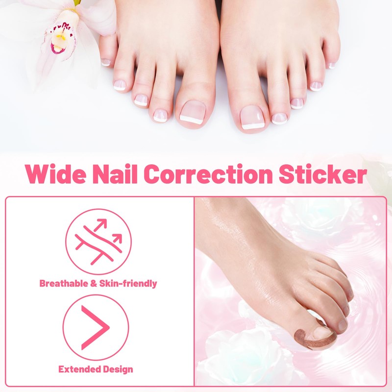 Ingrown Toenail Removal Kit Professional Ingrown Toenail Tool Kit with