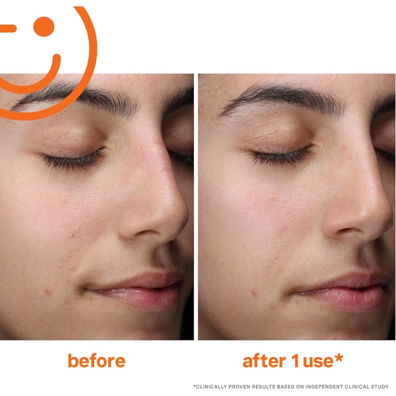 Kate Somerville ExfoliKate Cleanser – Daily Exfoliating Foaming Face Wash,