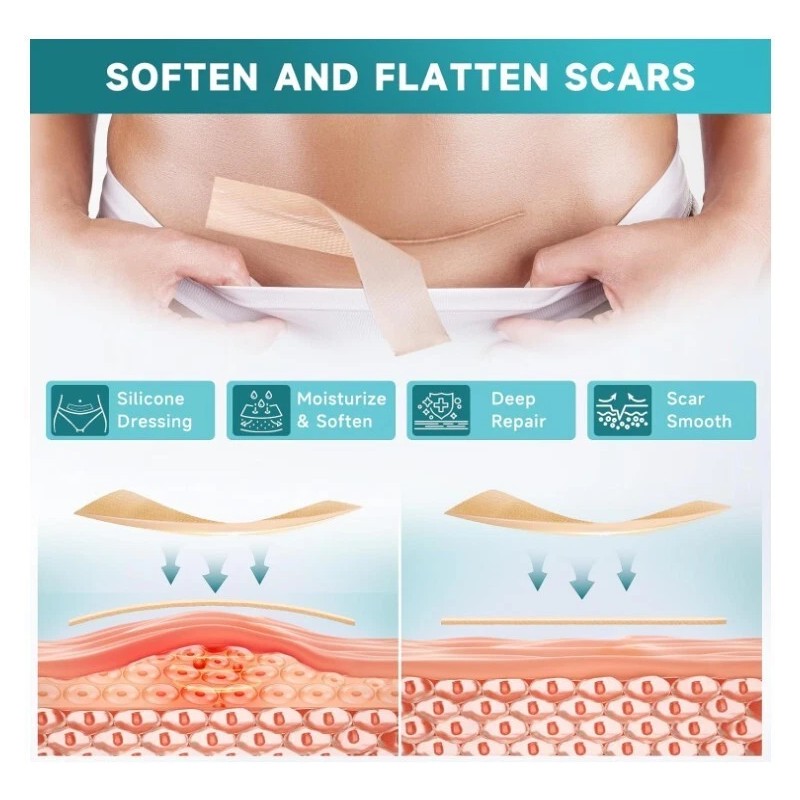 Pumkot Silicone Scar Tape Roll 1.6"x120" Surgical Scars Keloid Burn