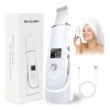 Cepillo Facial Ultrasónico Audishako para Limpieza Profunda y Exfoliación de Piel