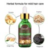 Anti-Hair Loss, Hair Growth Serum, Hair Loss and Hair Treatment,