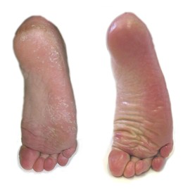 Barefoot Academy Ped Pro Cracked Heel and Callus Buffer for Soft and Smooth Feet! Comes with Bonus Emery Finishing Pads!