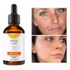 Universo en Linea Suero Vitamina C Bioaqua Blanqueador Reparacion Cuidado