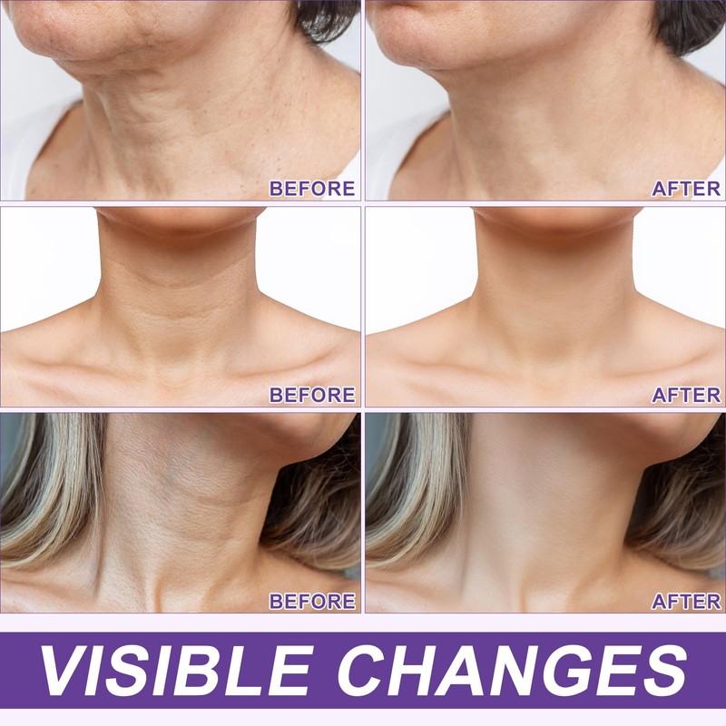 Firming Lift Neck Cream - for Sagging Skin & Wrinkle