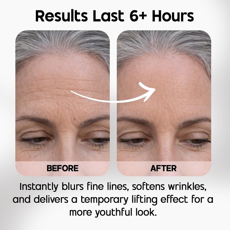 Celestolite Estrella Anti-Wrinkle Syringe