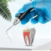 AZDENT Sistema de obturación endodoncia dental pluma calentada/cort - Endo