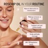 Eve Hanson Rosehip Oil - Organic Cold Pressed Seeds |Moisturizing