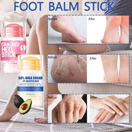 2Pcs Crack Feet Prevention Stick, Hydrating Heel Balm for Dry Cracked Feet,Moisturizing Foot Care Cream, Foot Balm Stick Intensive Repair Feets,Hands,Heels,Elbow and Knees and Softening Dry Skin