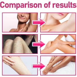 150 ML Gentle Formula Hair Removal Cream,Facial Hair Removal Cream,Sensitive H-air Rem-oval Cre-am,Moisturizing,Soothing And Non-Irritating,Fast&Painless Intimate Depilatory For Face,Legs,Underarms