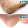 Cracked Foot Cream Roll-On Moisturizer, 1.76floz
