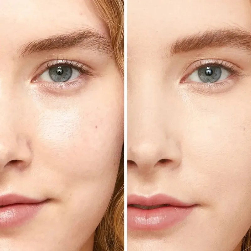 2 Pcs Contorno De Ojos Para Ojeras Bolsas En Los