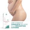 JAÏLYS Stretch Strips 125 ml | Prevention and Correction of