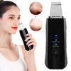 Face Skin Scrubber USB Rechargeable Peeling Machine Ultrasonic Exfoliating SkinCare(Black