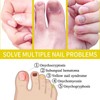  Rejuvenation Nail Growth Oil - Strengthens and Promotes Growth,Cosmetics