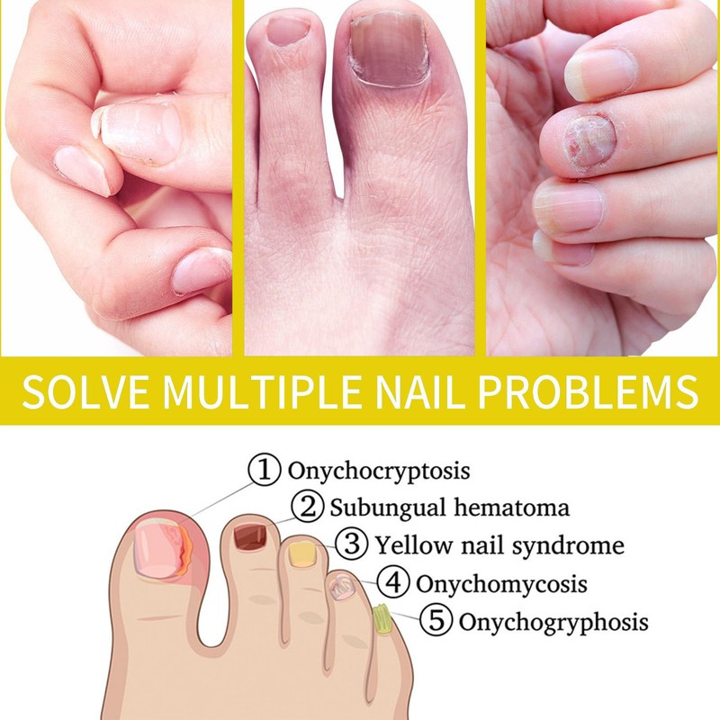  Rejuvenation Nail Growth Oil - Strengthens and Promotes Growth,Cosmetics