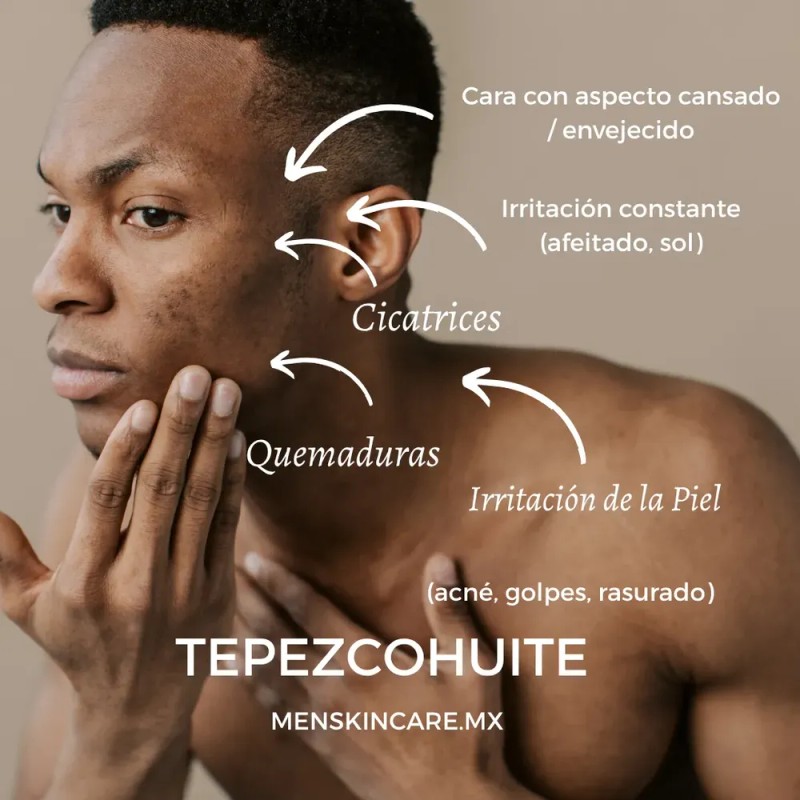 Crema De Tepezcohuite Fórmula Natural Para Regeneración