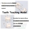 Detachable Dental Model Dental Disease Teaching Study Typodont Demonstration Tooth