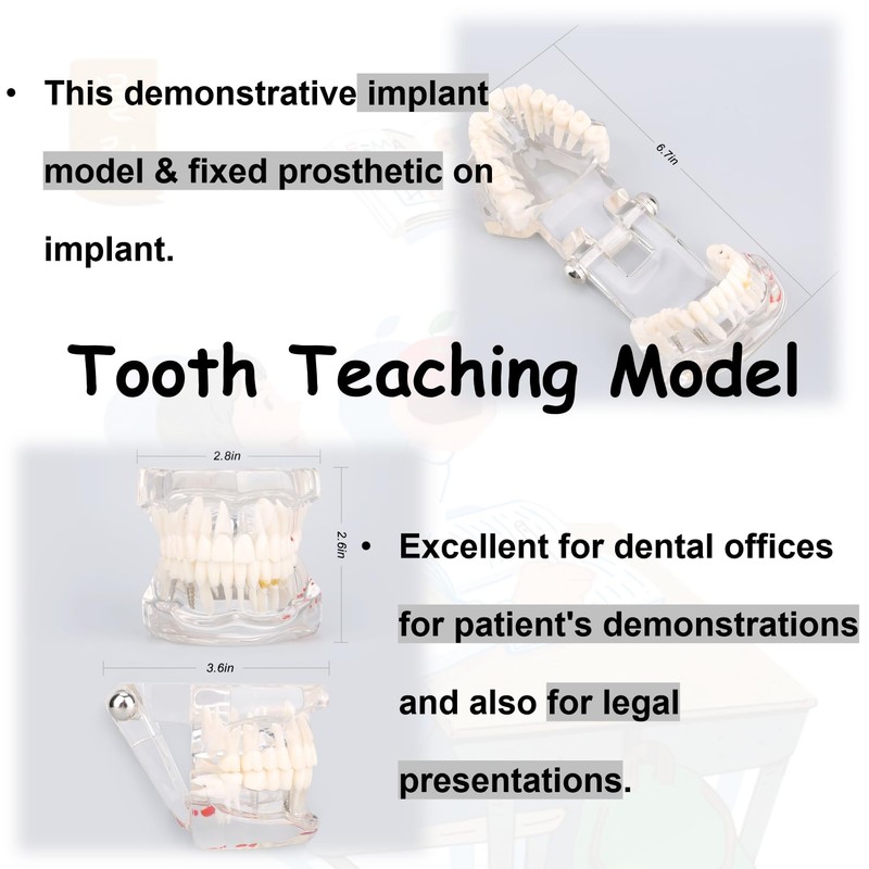 Detachable Dental Model Dental Disease Teaching Study Typodont Demonstration Tooth