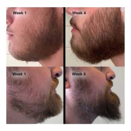 3pzs Derma Roller Barba Hombre