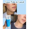 4 Crema Facial Baba De Caracol Manchas Sheló Nabel