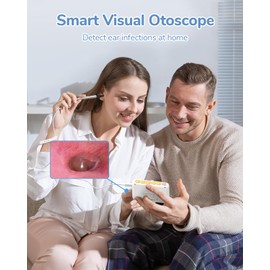 ScopeAround Otoscope with Light, 3.9mm Ultra-Thin HD Smart Visual Ear Camera, Digital Otoscope for Kids and Adults, Plug & Play Ear Wax Removal Tool Camera for Home Ear Inspection(White)
