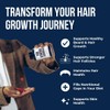 Evan Alexander Grooming My Growth Gummies | Healthy Hair &