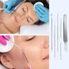 Blackhead Remover Tool Pimple Popper Tool Kit 5 Pack Blackhead